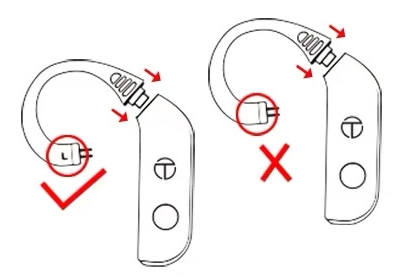 Correct TRN Scallop installation